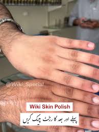 Wiki Special Skin Polish